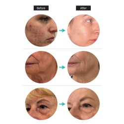 D'LEXO Cica Exo Comforting... 2